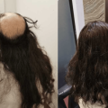Profile picture of Hair Replacement SG